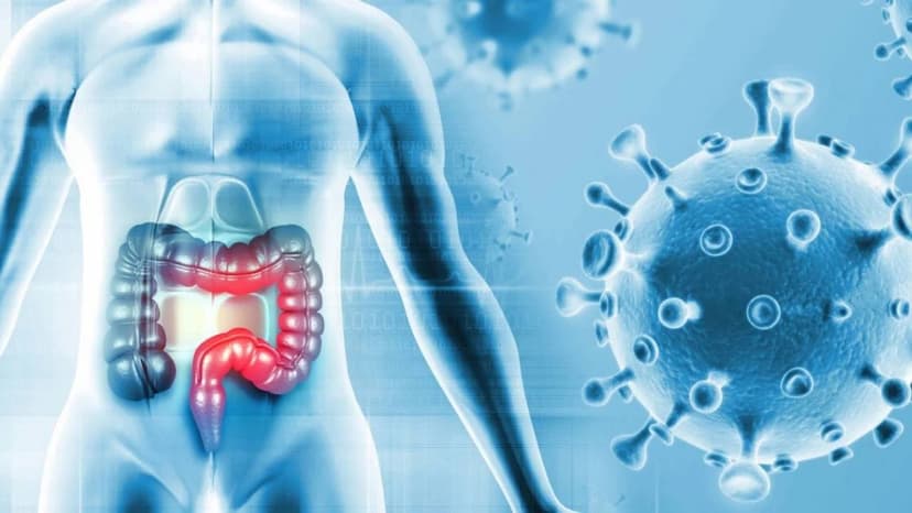 Giải đáp khi nào nên tầm soát ung thư đại trực tràng