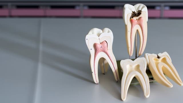 Lấy tủy răng số 7 có đau không?