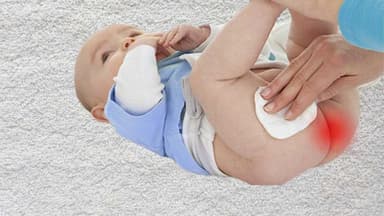 Nếp da thừa hậu môn ở trẻ có bẩm sinh không và khi nào cần can thiệp?