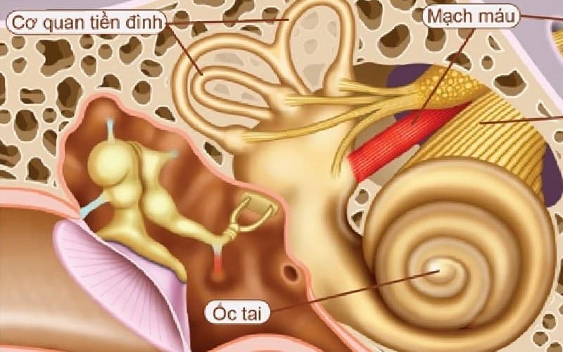 các kháng sinh gây điếc tai