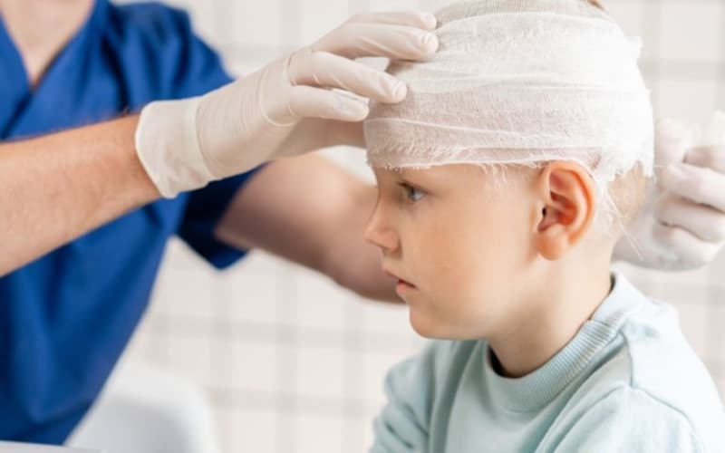 trẻ bị ngã rách da đầu