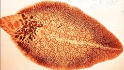 Sán lá gan chết ở nhiệt độ bao nhiêu?