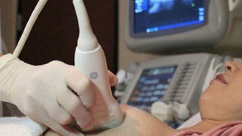 Có nên siêu âm vú khi có kinh nguyệt?