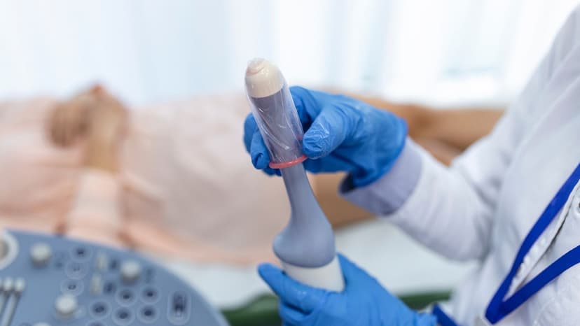 Siêu âm đầu dò âm đạo phát hiện bất thường nào của tử cung phần phụ?