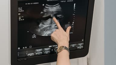 Các chỉ số trong siêu âm doppler tim và cách đọc kết quả