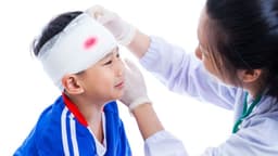 Trẻ bị ngã rách da đầu và hướng dẫn xử trí đúng cách