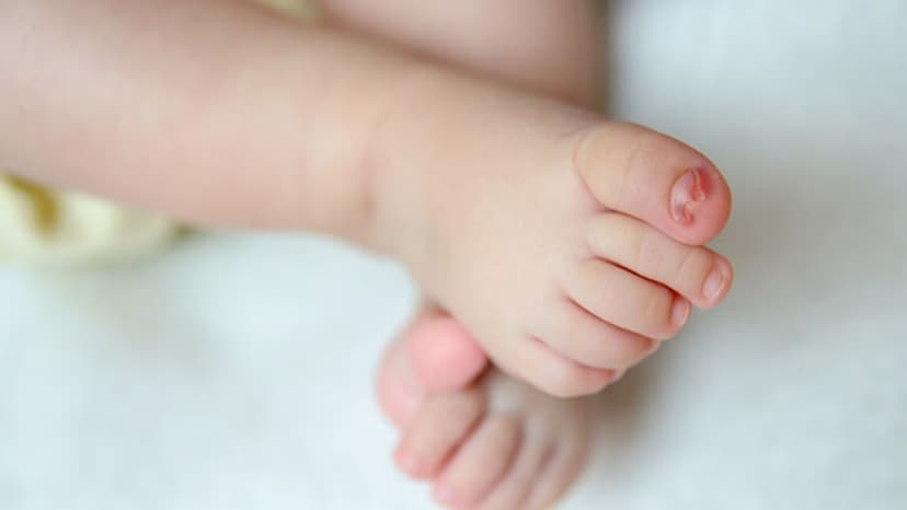 Trẻ sơ sinh bị móng chọc thịt: Nguyên nhân, dấu hiệu và cách xử lý an toàn