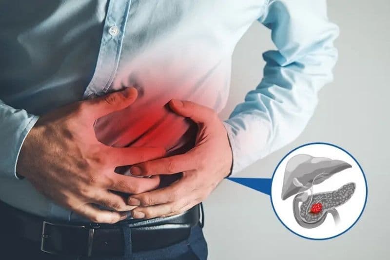 dấu hiệu sớm ung thư tuyến tụy