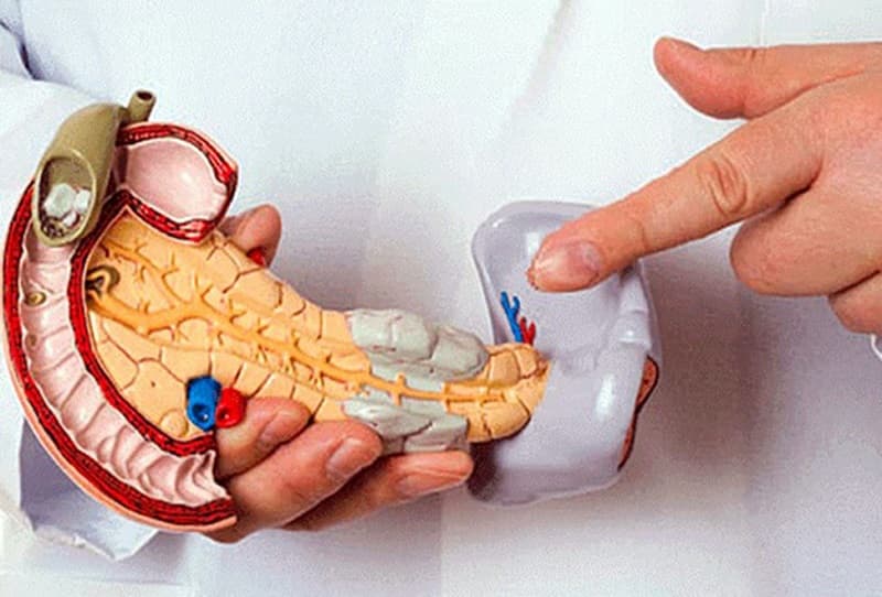 cách phát hiện ung thư tụy