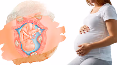 Bị u xơ tử cung có ảnh hưởng đến thai nhi?