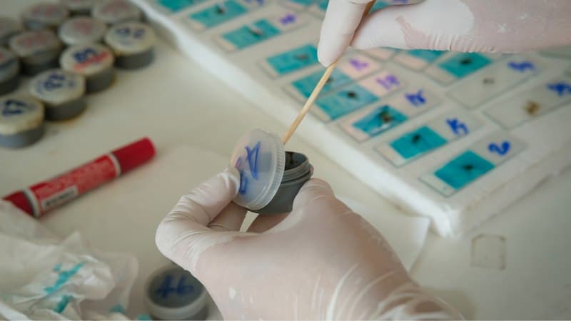 chỉ số xét nghiệm sán lá gan lớn