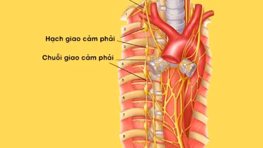 Khi nào cần đốt hạch thần kinh giao cảm: Các trường hợp được chỉ định