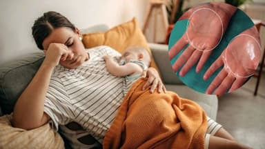 Vì sao phụ nữ bị tăng tiết mồ hôi sau sinh?