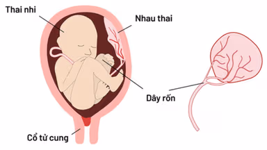 Bánh nhau dày là gì? Bánh nhau dày phải làm sao?