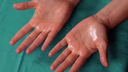 Bật mí các phương pháp giảm tăng tiết mồ hôi cơ thể hiệu quả