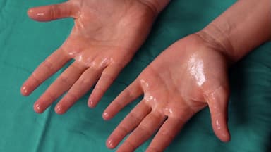 Bật mí các phương pháp giảm tăng tiết mồ hôi cơ thể hiệu quả