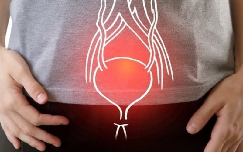 bàng quang tăng hoạt có nên nhịn tiểu