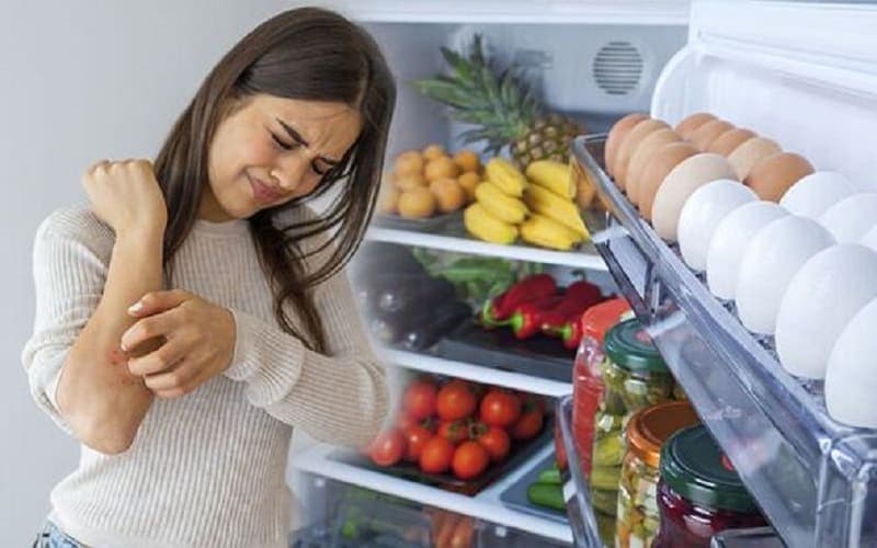 bị zona kiêng ăn gì