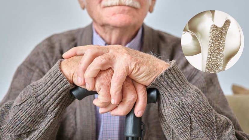 Điều trị và phòng ngừa các biến chứng về xương do ung thư tuyến tiền liệt