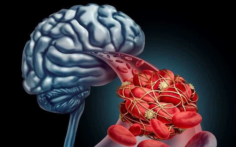 chống chỉ định tiêu sợi huyết