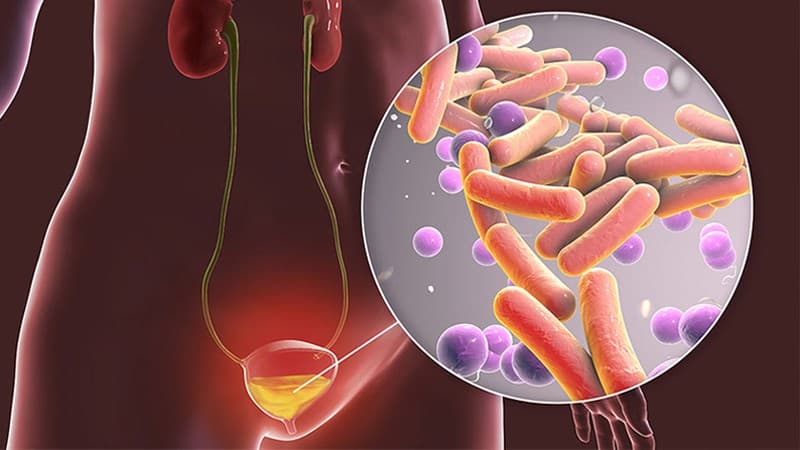 dày thành bàng quang là gì