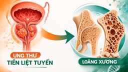 Nguy cơ loãng xương ở nam giới điều trị ung thư tiền liệt tuyến