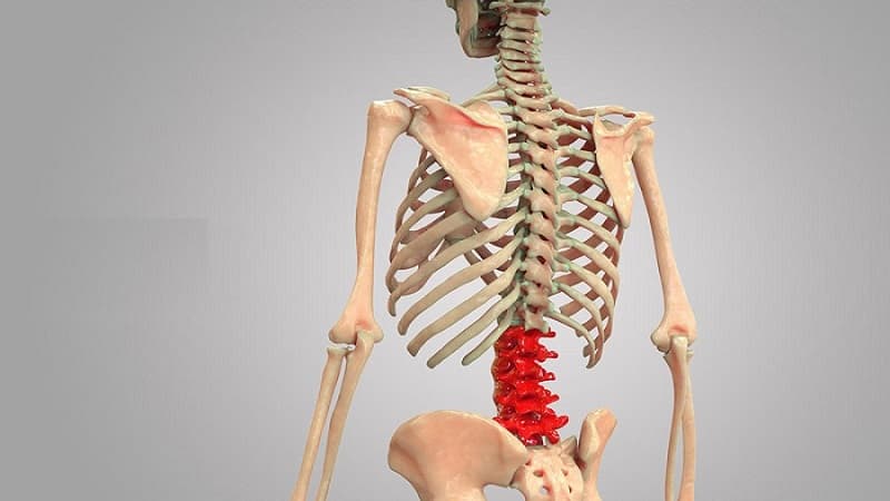 gãy eo đốt sống L5