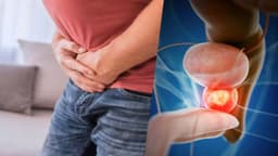 Hậu quả của ung thư tuyến tiền liệt