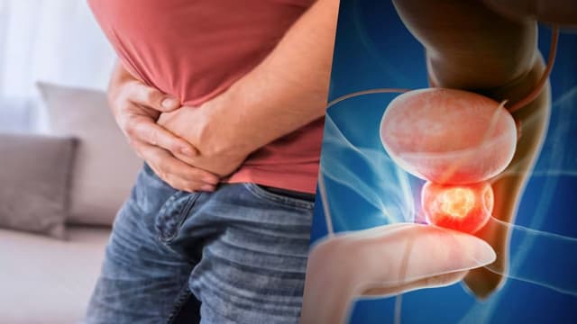 Hậu quả của ung thư tuyến tiền liệt