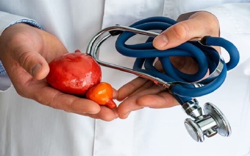 khối u bàng quang ở nam giới