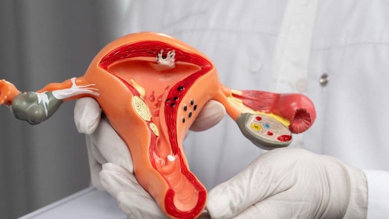 lạc nội mạc tử cung bàng quang