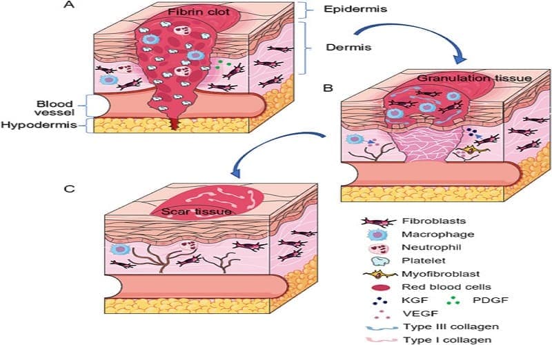 tổn thương cơ bản của tế bào và mô