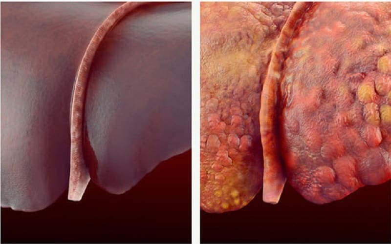 tổn thương cơ bản của tế bào và mô