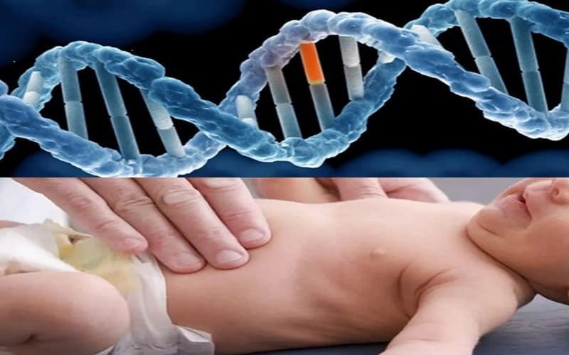 rối loạn chuyển hoá axit amin