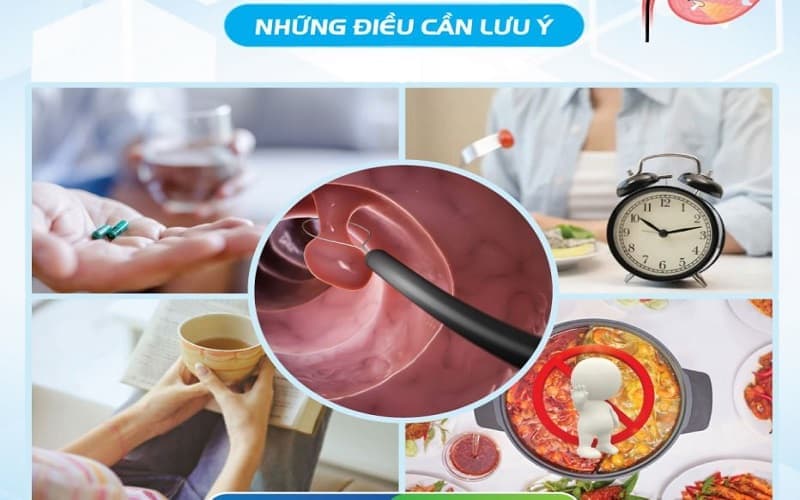 những lưu ý sau khi cắt polyp dạ dày