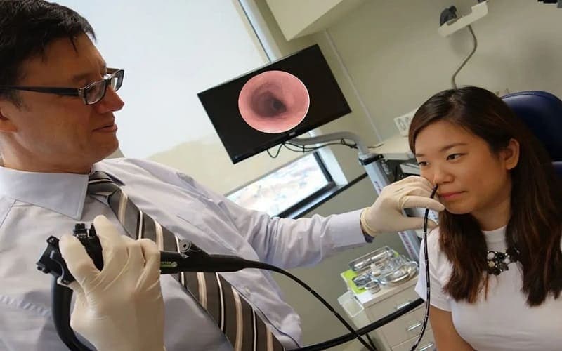 nội soi dạ dày qua đường mũi