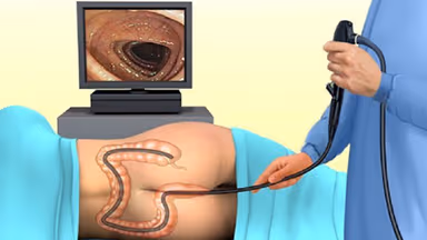 Nội soi đại tràng không gây mê có đau không?