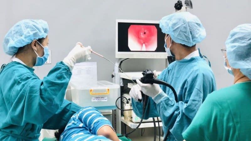 chỉ định nội soi xuất huyết tiêu hoá