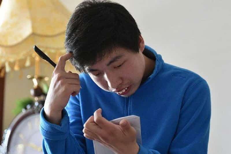 rối loạn chuyển hoá purine và pyrimidine