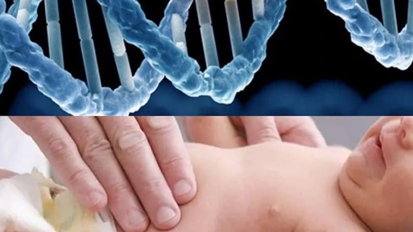 Rối loạn chuyển hóa axit amin ở trẻ sơ sinh là gì?