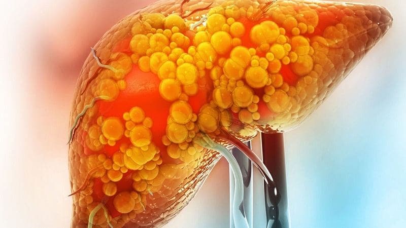 các bệnh liên quan đến rối loạn chuyển hóa lipid