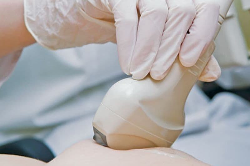 siêu âm có phát hiện ung thư vú không