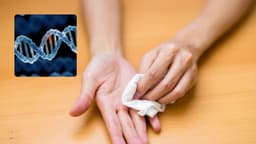 Tăng tiết mồ hôi có di truyền không và các dấu hiệu nhận biết