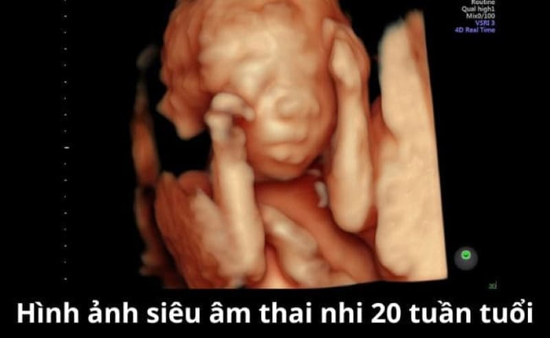 thai nhi 20 tuần tuổi phát triển như thế nào