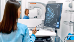 Ung thư vú phát hiện sớm có chữa khỏi không?