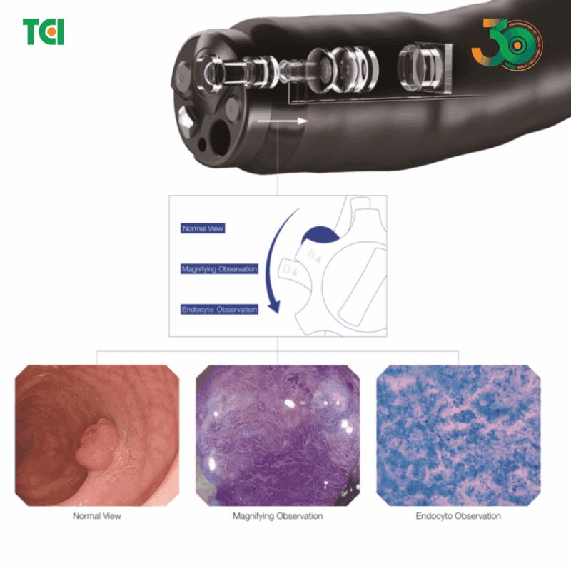 Nội soi phóng đại cấp độ tế bào Endocyto 520x