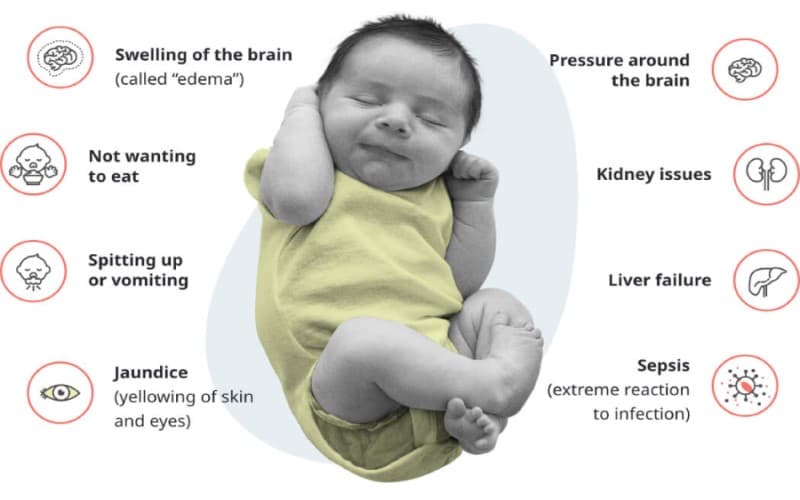 rối loạn chuyển hóa galactose có nguy hiểm không