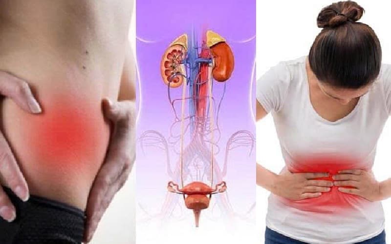 viêm bàng quang xuất huyết ở nữ