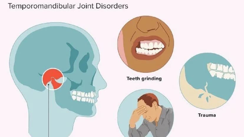 Viêm khớp thái dương hàm có gây lệch mặt không?