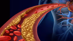Xét nghiệm rối loạn chuyển hóa lipid
